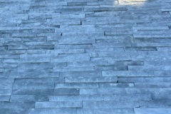 veneer-5