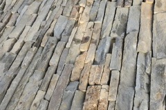 veneer-6